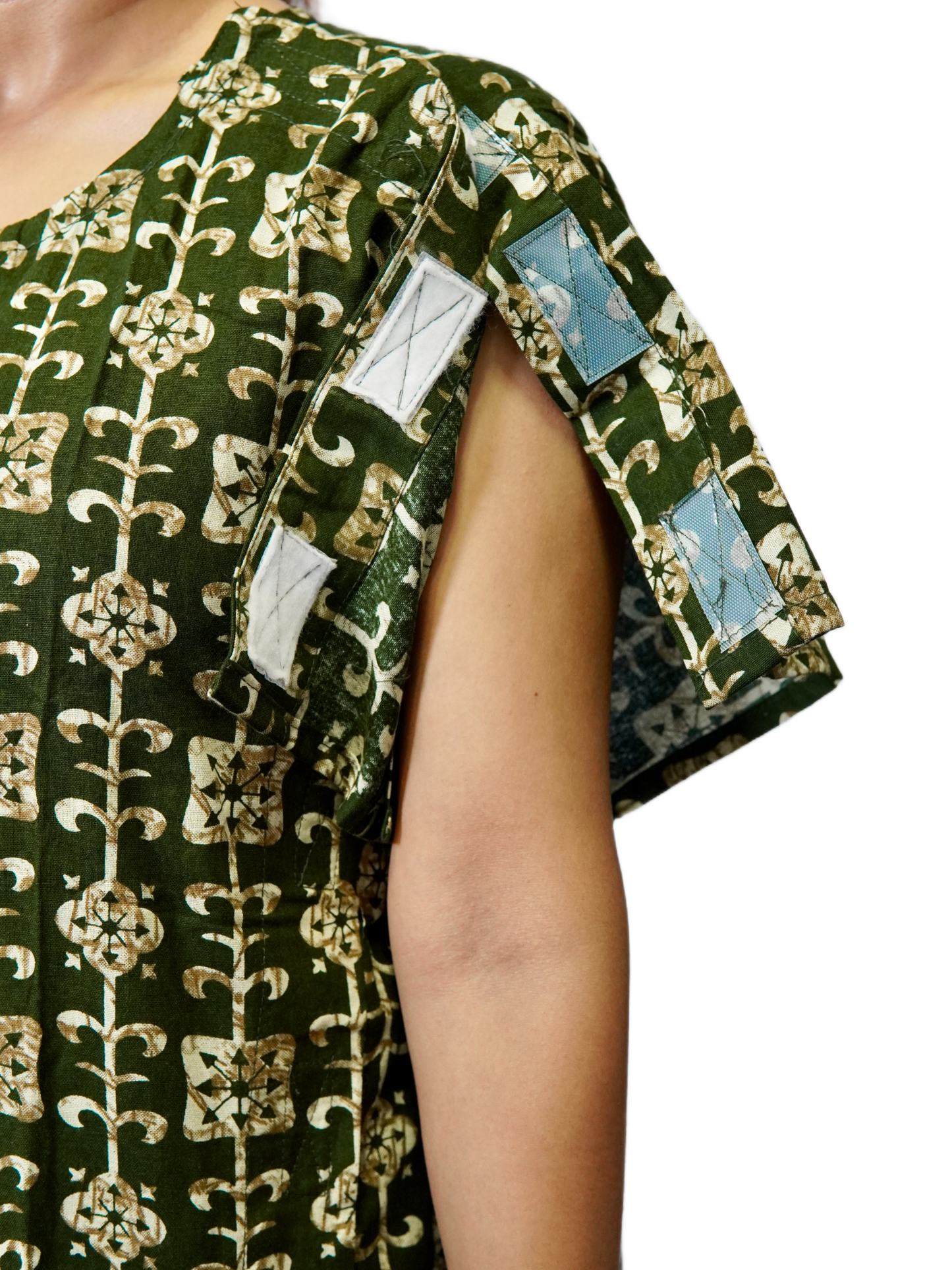 Sleeve opening of side open gown