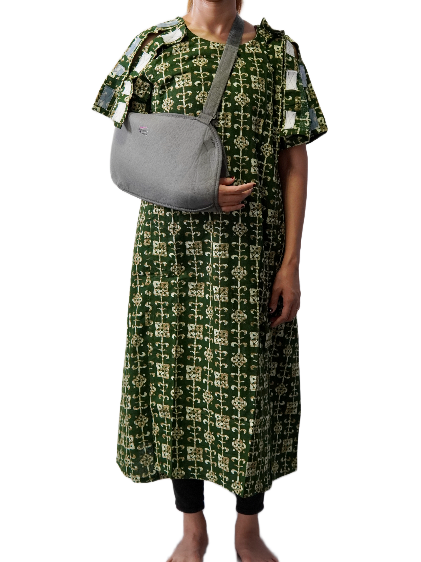 Woman with right hand fracture wearing side open gown